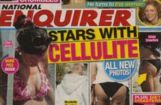 Celebridades con Celulitis