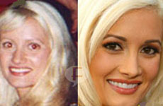 Holly Madison (Playboy): Antes & Después