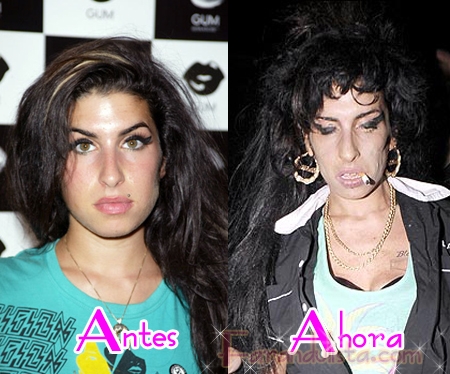 amy before after