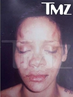 rihanna pictures attack.thumbnail