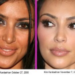 kim kardashian before after