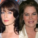 lara flynn boyle plastic surgery before after