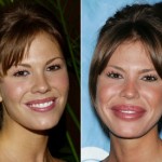 nikki cox before and after plastic surgery photos