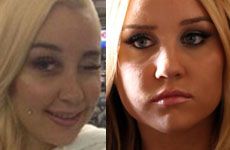 Amanda Bynes es Esquizofrénica?