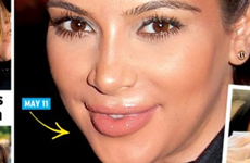 Kim Kardashian: cirugias plásticas embarazada?? [InTouch]