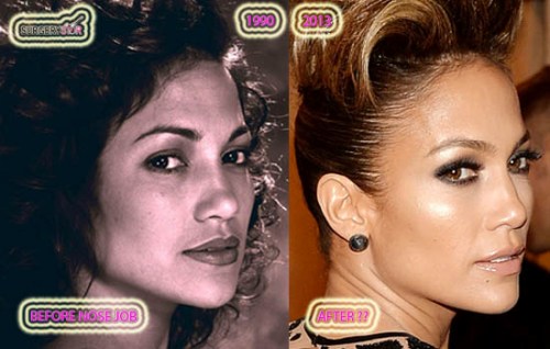 Jennifer Lopez Nose Job Before After