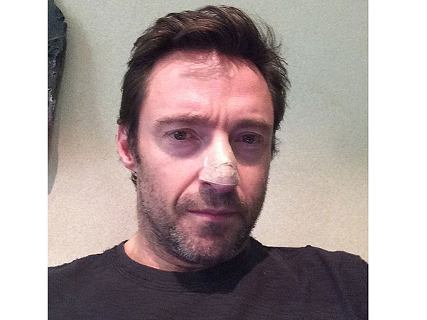 hugh jackman skin cancer