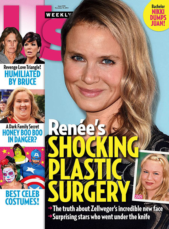 Us Weekly Renee Zellweger plastic surgery