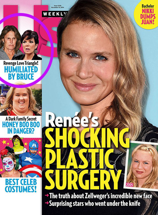 Us Weekly Renee Zellweger plastic surgery 1