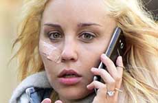 Amanda Bynes se operó de nuevo? Actúa CRAZY!