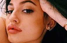 WTF? A que se parecen los labios de Kylie Jenner?