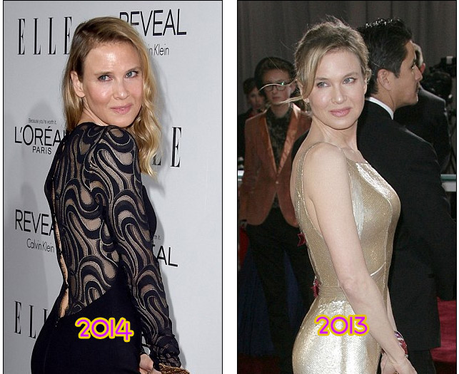 renee zellweger antes despues