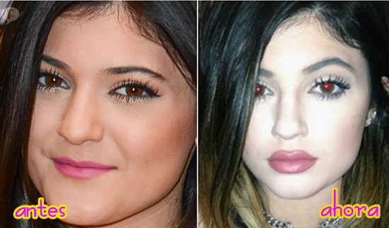 kylie jenner antes despues before after