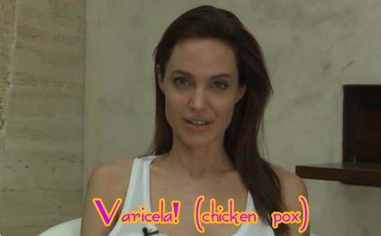 angelina jolie varicela chicken