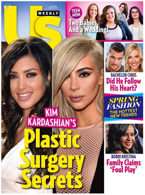kim kardashian plastic surgery secret us