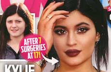 Kylie Jenner: 7 cirugías plásticas a los 17 [OK!]