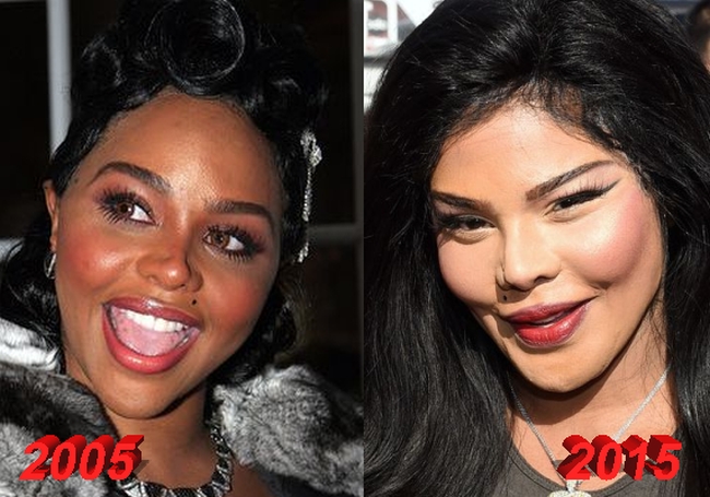 Lil Kim plastic surgery 2005 2015