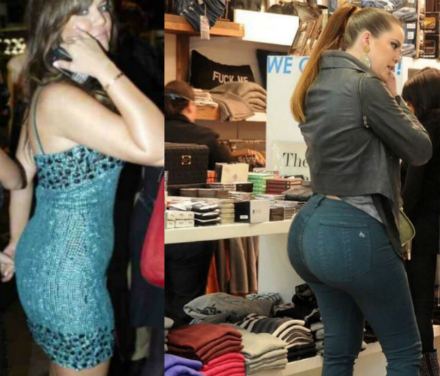 khloe kardashian butt before after