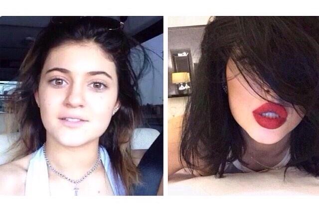 kylie jenner lips huge 1