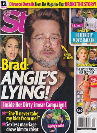 Team Brad