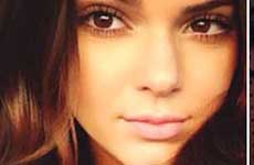 Kendall Jenner se inyectó los labios!! WHAT?