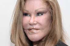 Jocelyn Wildenstein, La Catwoman arrestada por rasguñar al novio