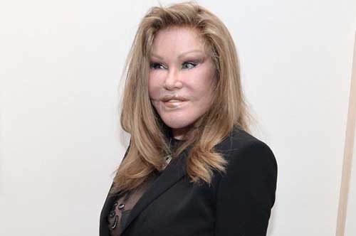 jocelyn wildenstein