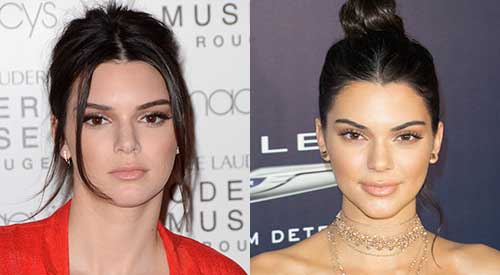 kendall jenner antes despues