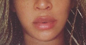 Beyoncé no se inyectó los labios! Está hinchada por el embarazo!!