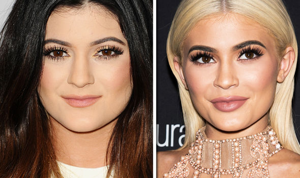 Kylie Jenner plastic surgery Before and after