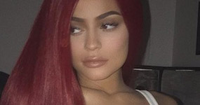 Kylie Jenner inspira a jovencitas para cirugías plásticas! Billion Dollar Baby!