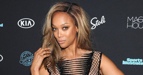 Tyra Banks revela cirugía plástica!