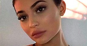 Kylie Jenner ya no usa relleno en los labios. What?