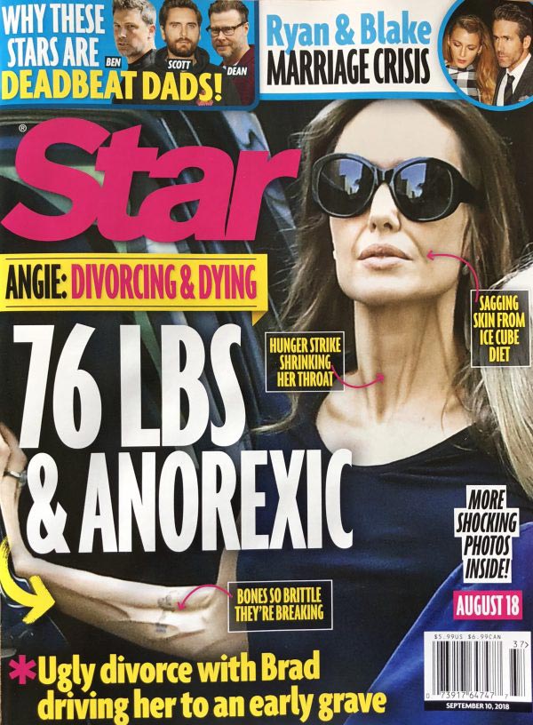 Angelina Jolie Anorexic Brad Pitt divorce Star