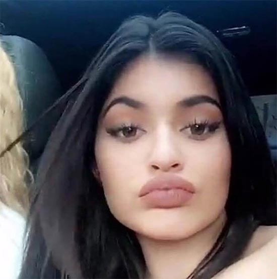 kylie jenner lips journey