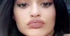 Kylie Jenner grabó su experiencia con los LIP FILLERS!!