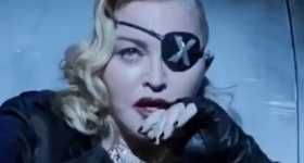 Madonna se cayó de una silla y suspende concierto en París