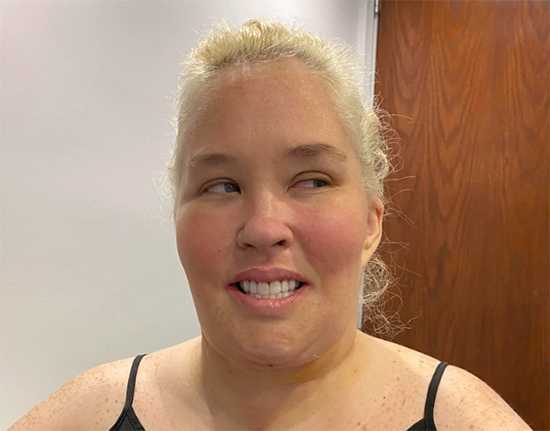 mamajune lipo new teeth