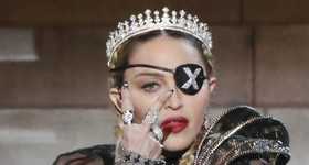 Madonna muestra cicatriz de cirugía de cadera