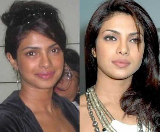 priyanka chopra cirugias antes despues