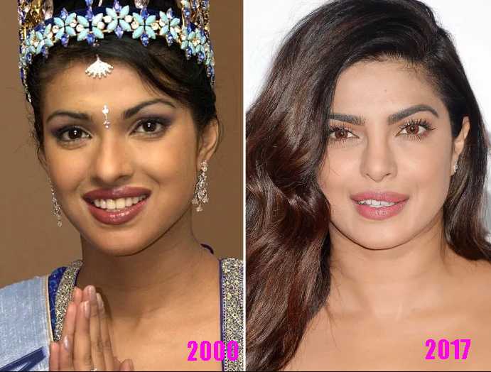 priyanka chopra jonas antes despues