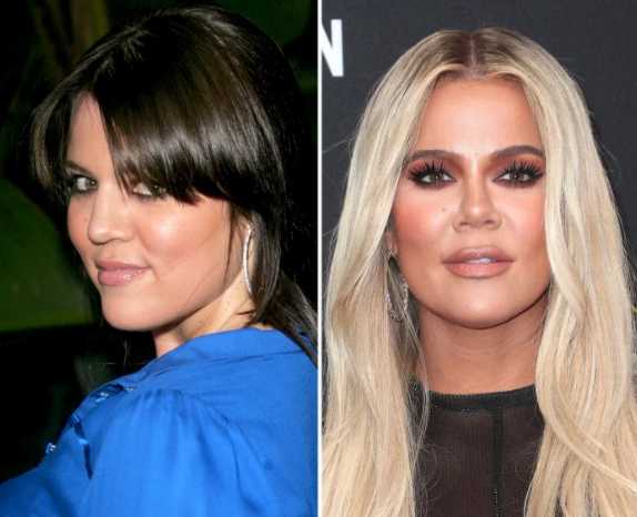 khloe before after