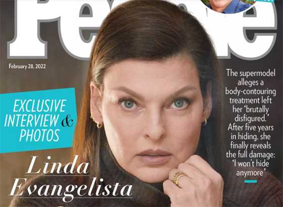 Linda Evangelista muestra su cuerpo desfigurado tras procedimiento quirúrgico