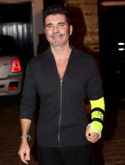 Simon Cowell se partió un brazo en su bici eléctrica