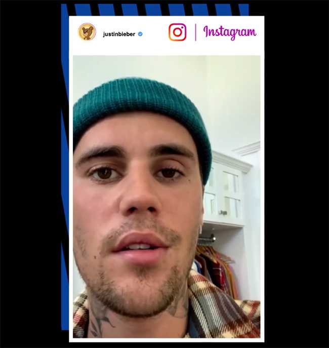 justin bieber paralizado media cara virus