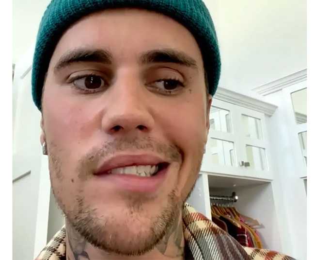 Justin Bieber mucho mejor tras revelar parálisis en media cara