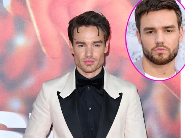 La cirugía plástica de Liam Payne. WTF???