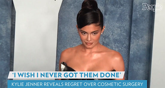 Kylie Jenner se arrepiente de su cirugía plástica