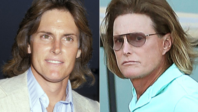 Bruce Jenner en 1987 y el 2014