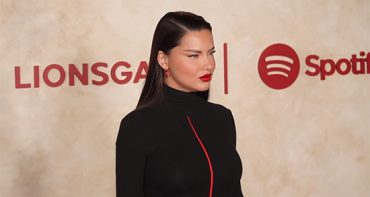 OMG! Qué le pasó a la cara de Adriana Lima?